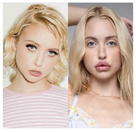 chloe cherry before lip injections